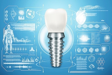 写真：バイオインプラントについて～歯根膜再生を目指す次世代治療の研究と実用化の見通し