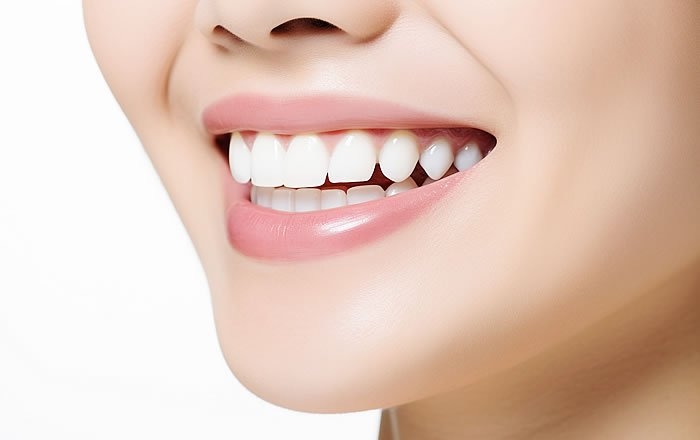 ジルコニアインプラントのメリット：上部構造の仕上がりが美しくなる