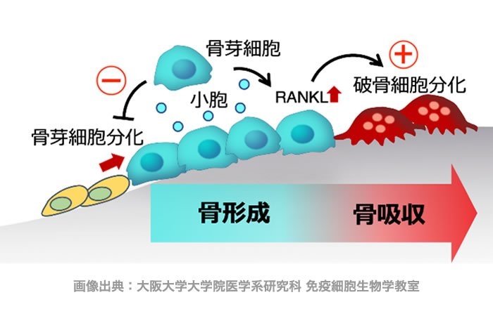 圧迫力を受けた側では破骨細胞(はこつさいぼう)と呼ばれる細胞が生まれて顎の骨を溶かし、反対側では骨芽細胞(こつがさいぼう)という細胞が出てきて骨が作られます。