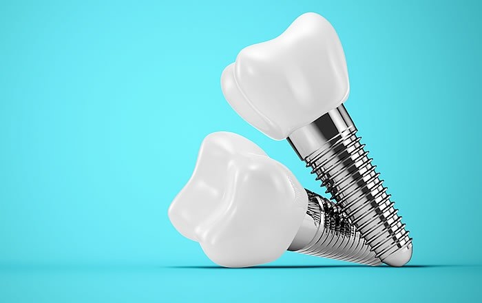 1ピースタイプのインプラント