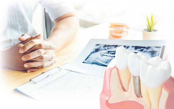 インプラント治療に際し、押さえておくべきポイント：信頼できる歯科医院で治療を受ける