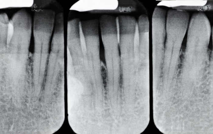 レントゲン・CT検査