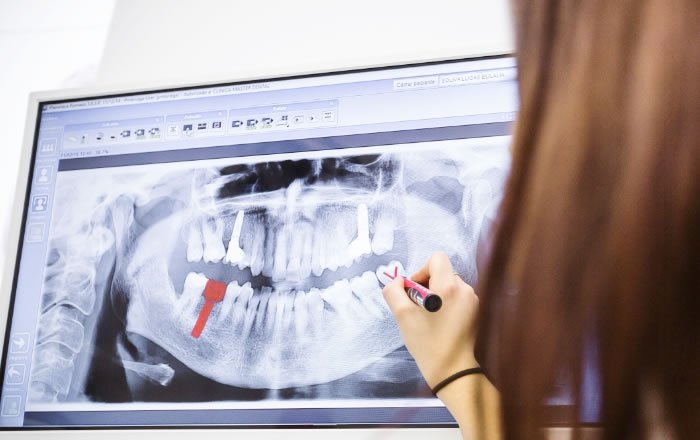 治療計画の立案