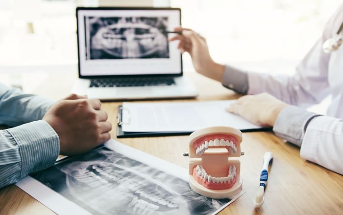 インプラント手術を成功に導くためのポイント：カウンセリングは納得いくまで