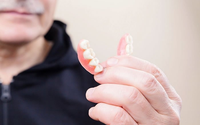 オールオン4(All-on-4®)のメリット:外れない