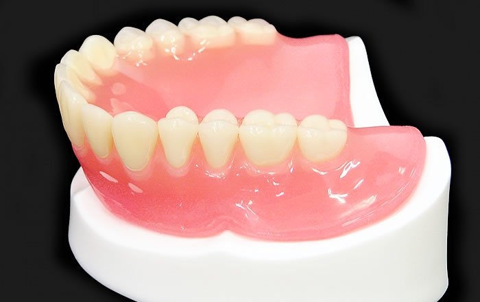 オールオン4(All-on-4®)のデメリット:保険の総入れ歯と比べると治療費が高い