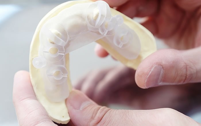 サージカルガイドとは