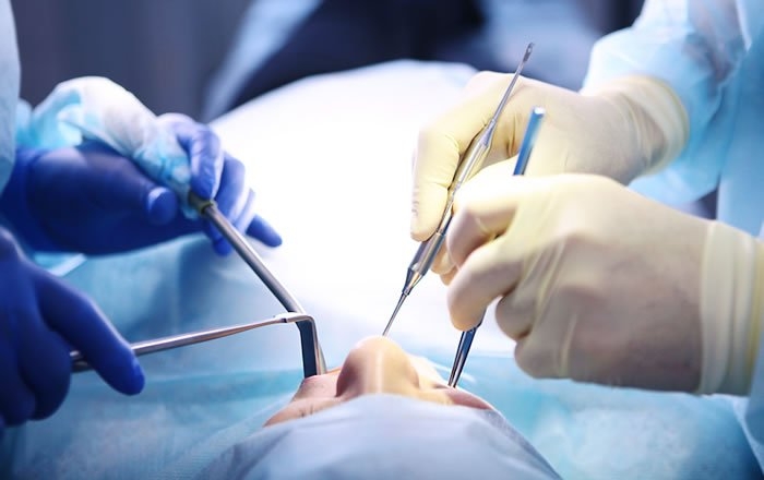 治療の難易度が高い