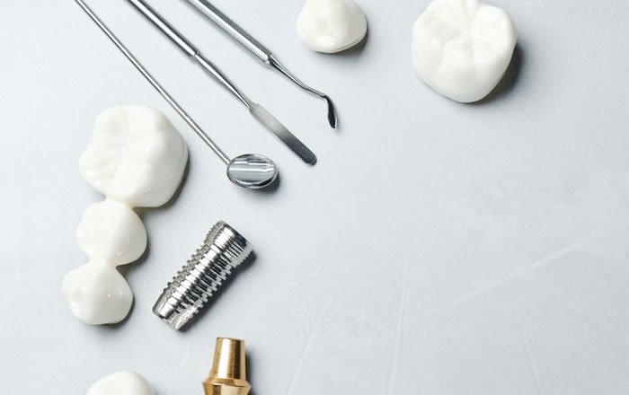 上部構造の破損や脱落