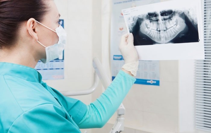 ミニインプラントのデメリット：骨が薄すぎると使用できない