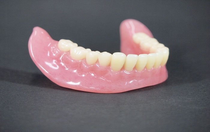 ミニインプラントをおすすめする方：入れ歯が動いて安定しない方