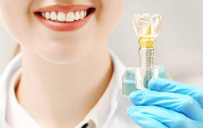 ドライマウスを防いでインプラントを守ろう