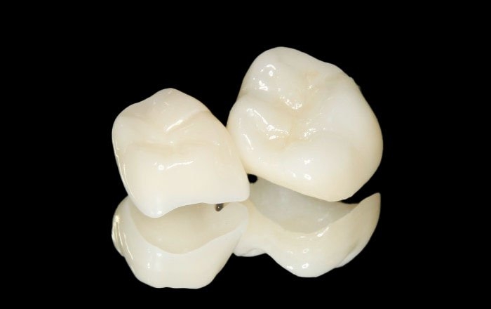 セラミックは変色しにくい素材