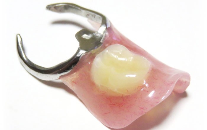 入れ歯の特徴：隣の歯を削る量が少ない