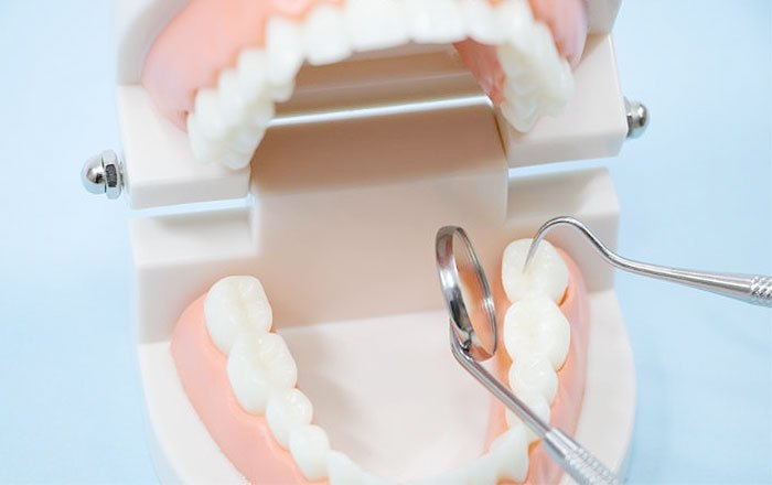 今の入れ歯をインプラントに変えられる？