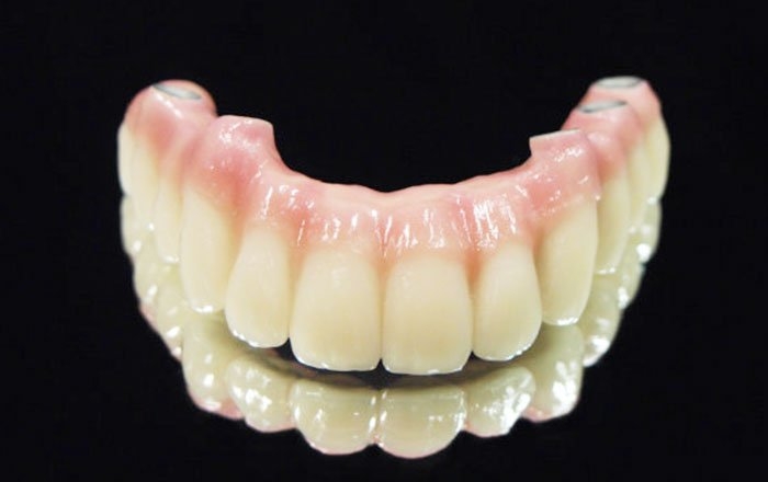 今の入れ歯をインプラントに変えられる？