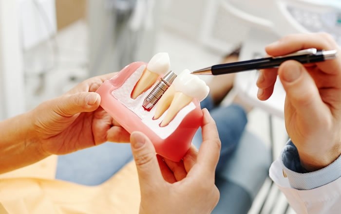 インプラントへのタバコの害：手術後の治りが悪くなる