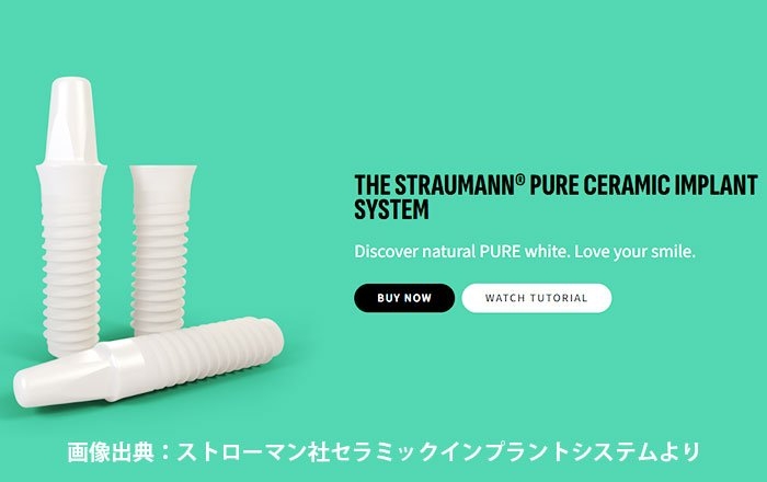 チタン製インプラントとは異なり、ジルコニアインプラントとは、フィクスチャー・上部構造・アバットメントのすべてにジルコニアというセラミック素材を使用したインプラント