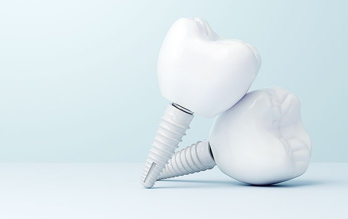 ジルコニアインプラントとは？