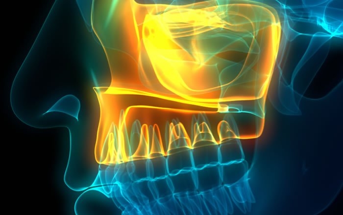 前歯部のインプラント治療は難しい理由：骨の厚みが薄い傾向にある