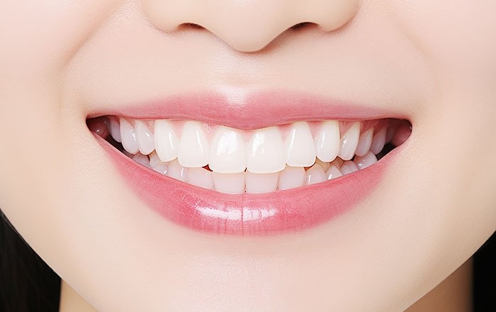 インプラントの間隔や位置が大切なのはどうして？：仕上がりの見た目を左右するため（審美面）