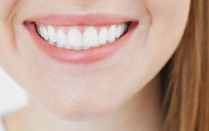 前歯部のインプラント治療は難しい理由：対称性が求められる