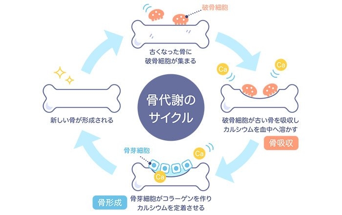 骨粗しょう症とは？