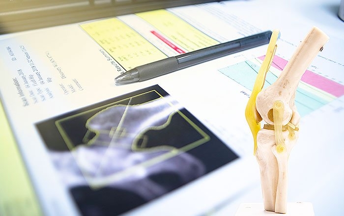 骨粗しょう症だとインプラント治療を受けられない？