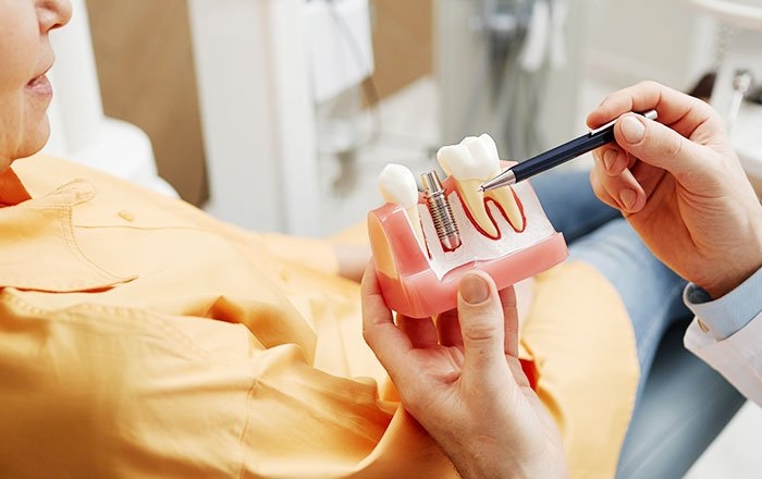 インプラント治療の「結果」への影響