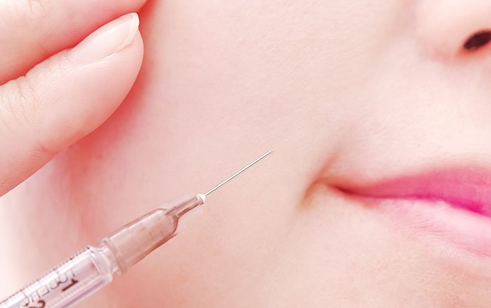 歯ぎしりからインプラントを守るために：ボツリヌス注射