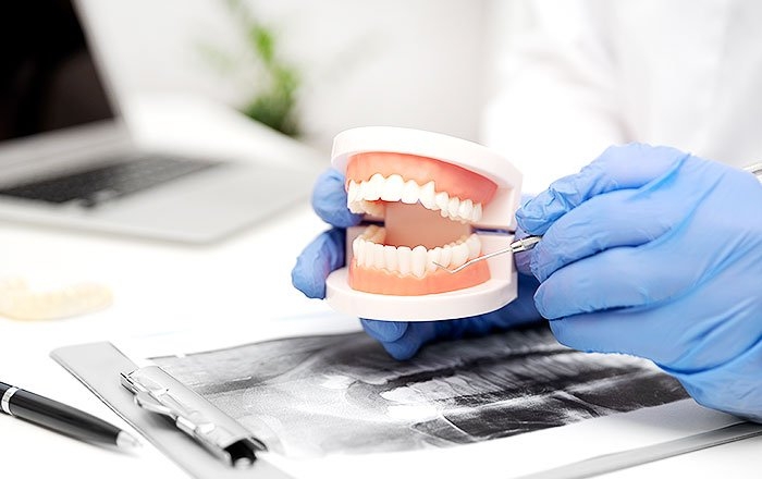 総入れ歯でお悩みの方はインプラントロケーターも選択肢に