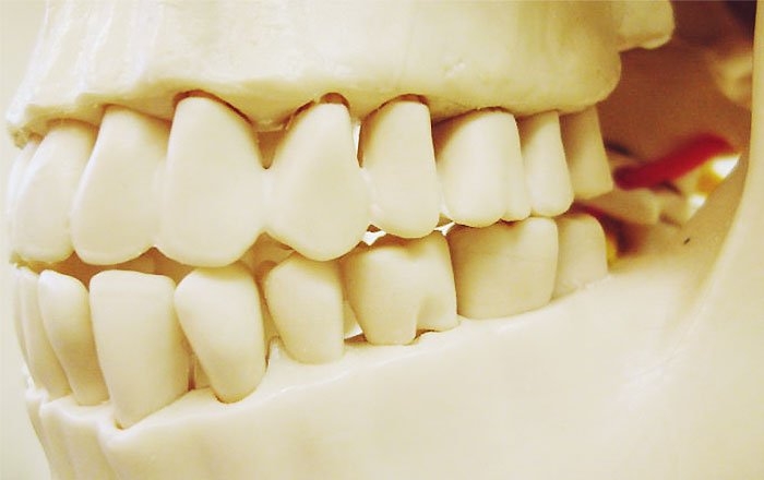 インプラントロケーターのメリット：骨の安定化も期待できる