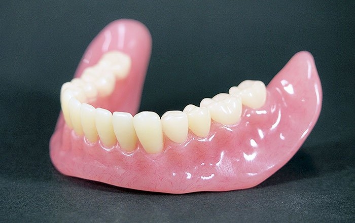 インプラントロケーターのメリット：入れ歯を小さくできる可能性がある