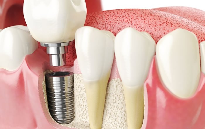 手術後の転院はハードルが上がる