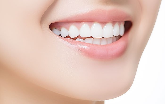 ベニアグラフトのメリット：見た目が美しくなる