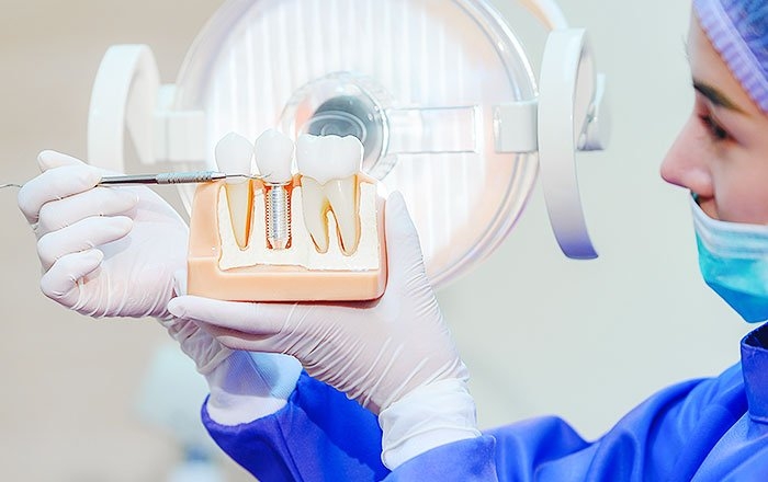 インプラント治療の転院先を選ぶ際のポイント：インプラント治療・メンテナンスに対応している歯科医院を選ぶ