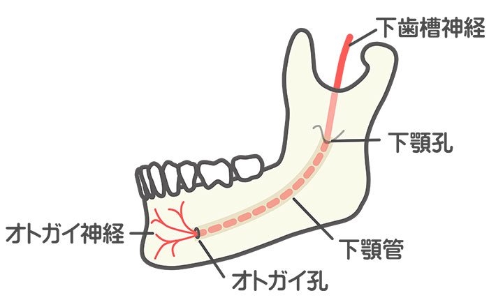 オトガイ神経を損傷した場合の症状