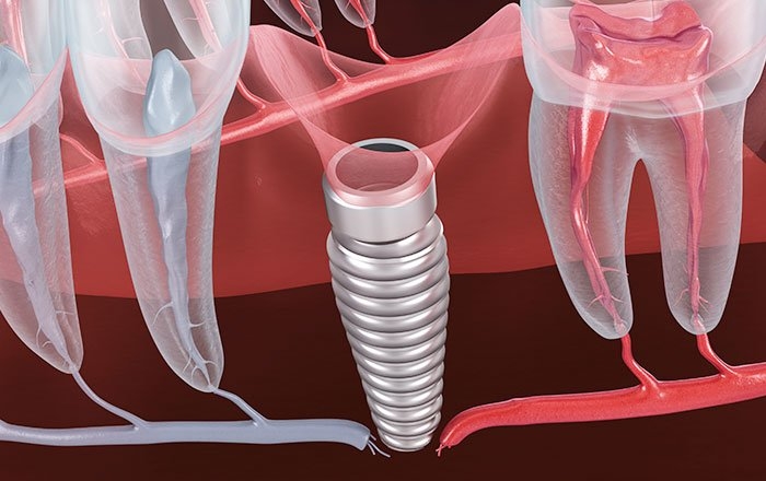 神経がしびれる原因と治療法：損傷が原因の場合