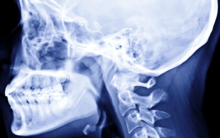 顎の骨格の変化