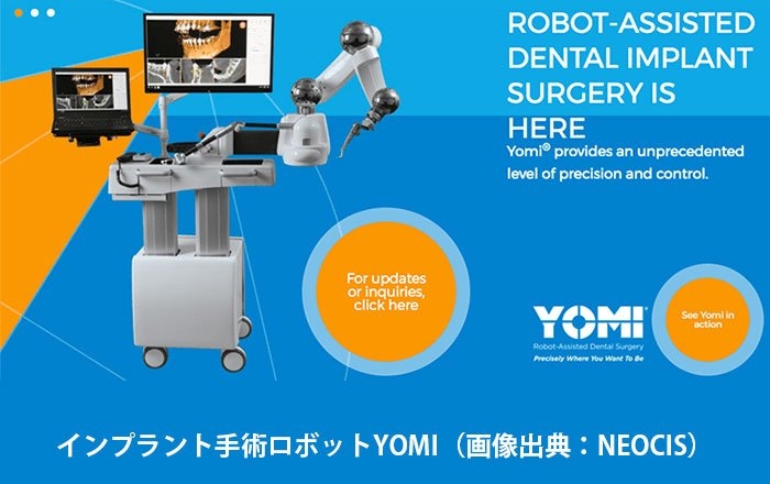 インプラント手術ロボット：YOMI