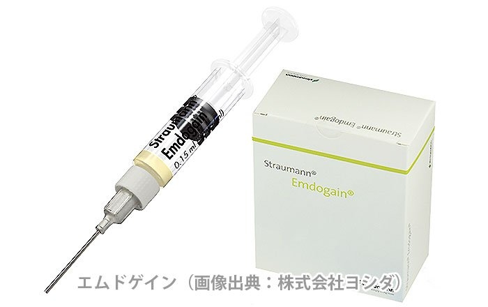 エムドゲインとは？