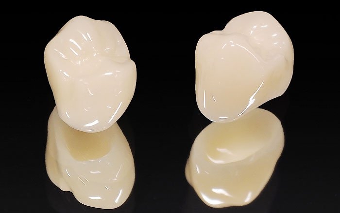 上部構造の材質と特徴：ハイブリッドセラミッククラウン