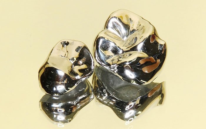 上部構造の材質と特徴：銀歯