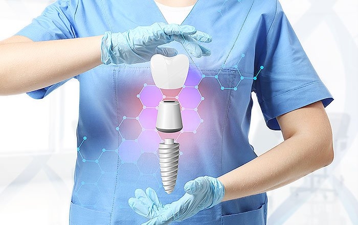 インプラントに使われる材質の特徴を理解しよう