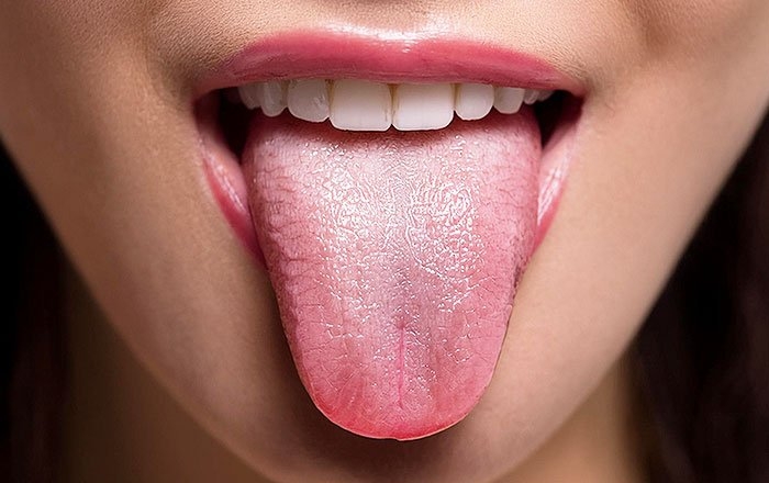 インプラントで味覚が変わることはない