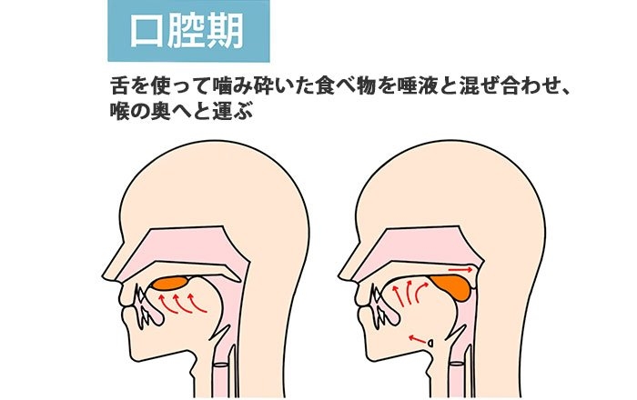 嚥下におけるインプラントの効果：食塊（しょっかい）を作るのにも好影響