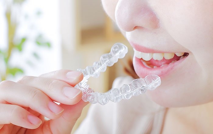 全体の歯並び悪く、抜けている歯もあるなら矯正治療を先に行う