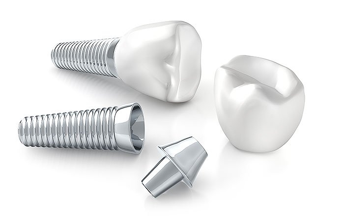 メーカー各社は、インプラントと顎の骨の結合をいかに早く、強く、長期間安定させるかについて、長年研究開発を重ね、しのぎを削っています