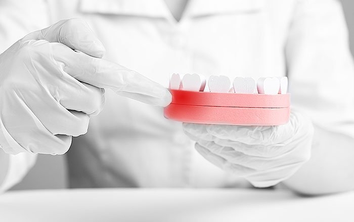 インプラント手術直後に起こりやすいトラブル：出血