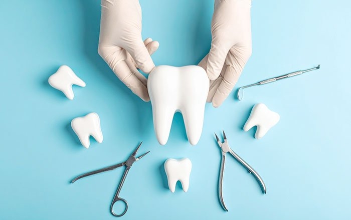 ソケットプリザベーションを行うタイミング